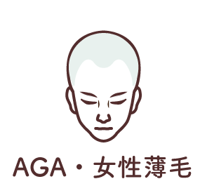 AGA女性薄毛